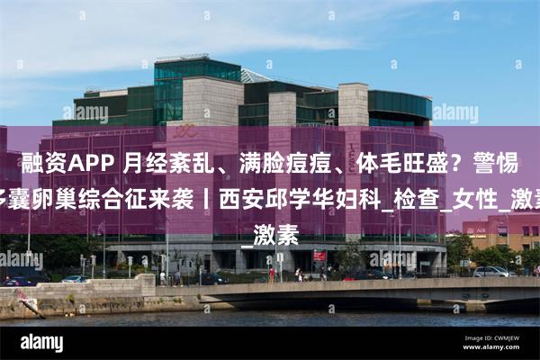 融资APP 月经紊乱、满脸痘痘、体毛旺盛？警惕多囊卵巢综合征来袭丨西安邱学华妇科_检查_女性_激素